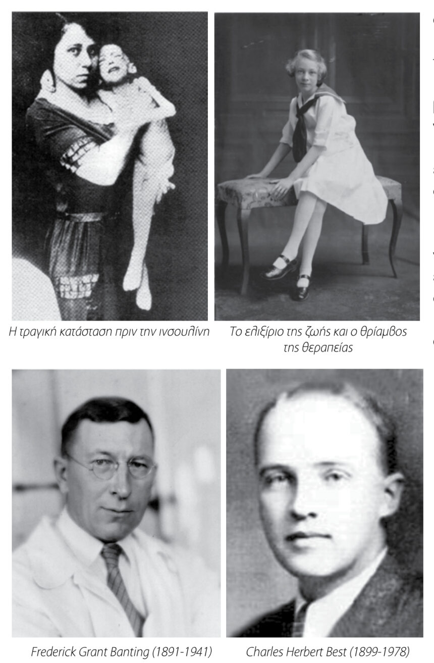 anakalypsi insoulinis