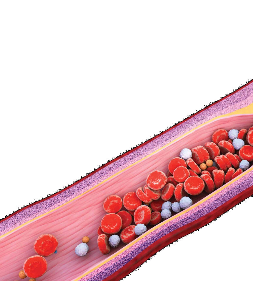 dyslipidaimia