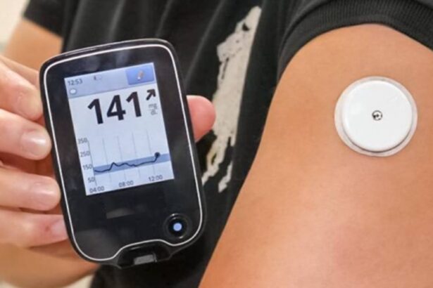 syskeves cgm ston diaviti typou 2 axizoun choris insoulini